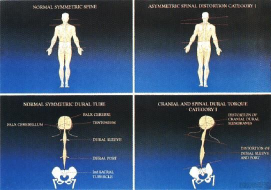 Sacro-Occipital Technique - Pittsburgh Natural Healthcare Services